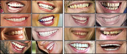 This is an image of British celebrities’ teeth before an American dentist got his hands on their chops.